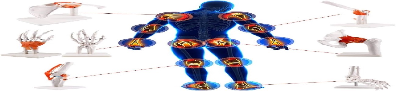 جراحة المرارة