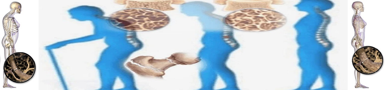 جراحة المرارة بالمنظار